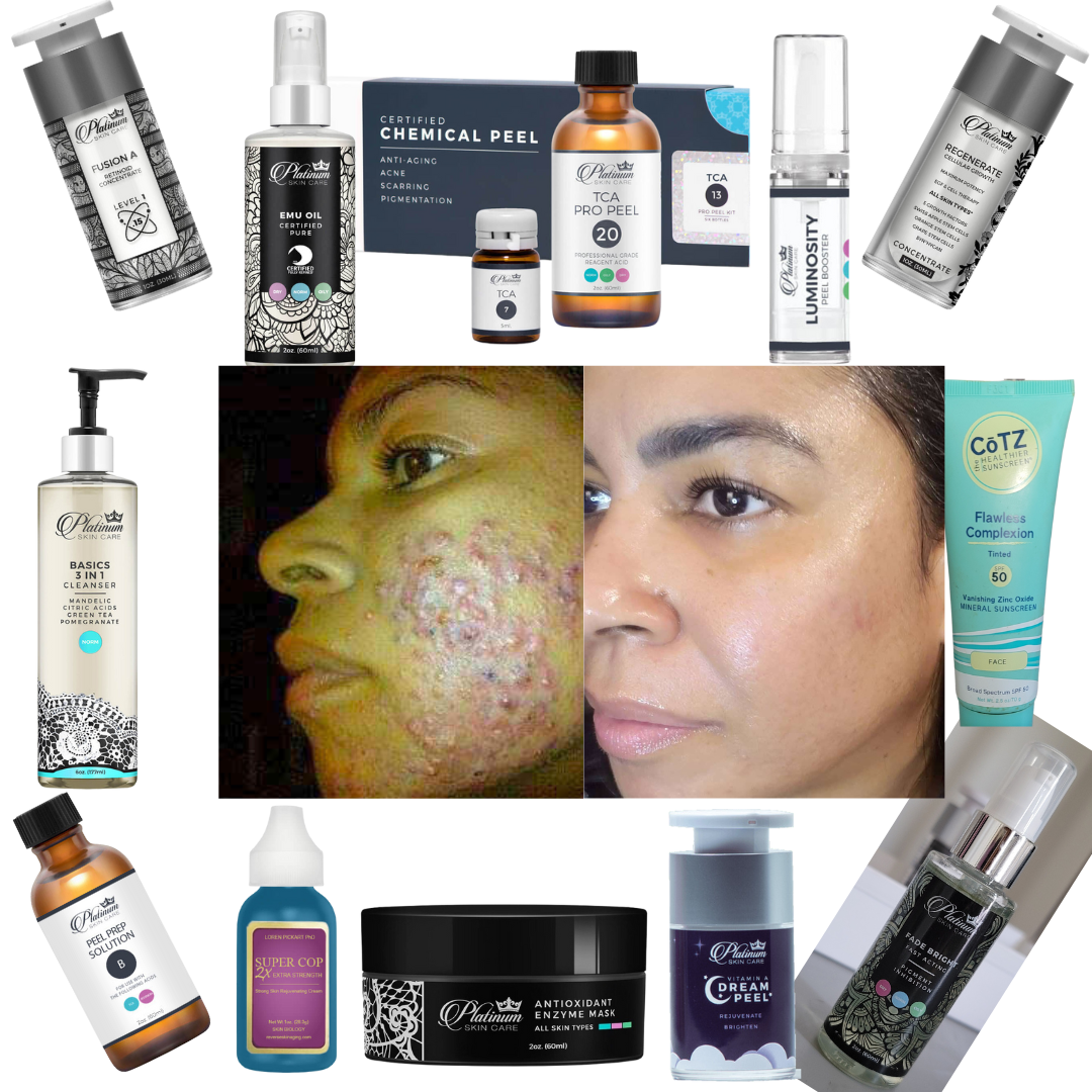 DETOX BODY SKIN N MIND AFFILIATE LINKS